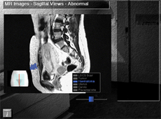 A screenshot of the Cytofocus program showing an MR scan
